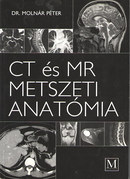 Online antikvárium: CT és MR metszeti anatómia