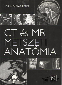 Könyv: CT és MR metszeti anatómia